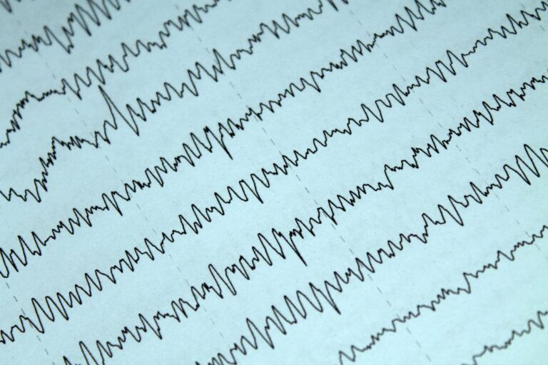 EEG
