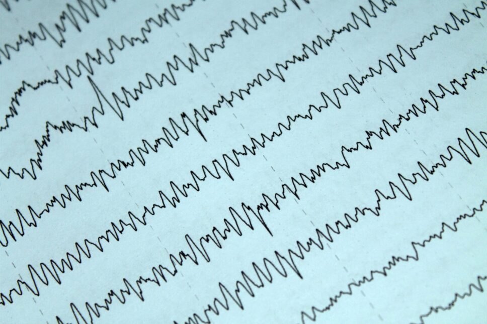 EEG